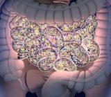 Neurodermatitis and allergies are linked to intestinal health